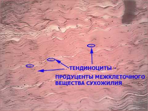 Плотная оформленная ткань сухожилия