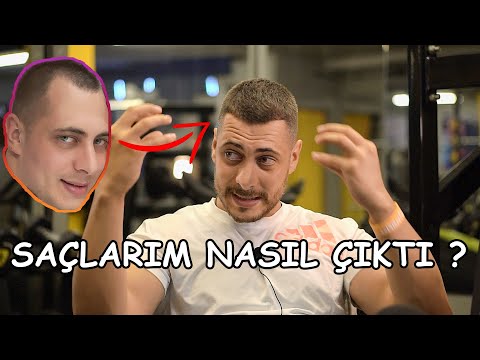 Saçlarım nasıl tekrardan çıktı Saç Dökülmesi İçin Önlemini Al !