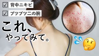 【韓国美肌ケア】背中ニキビ跡と二の腕ブツブツのケアはコレで解決‼️ハイドラボディ【オラクル美容皮膚科】