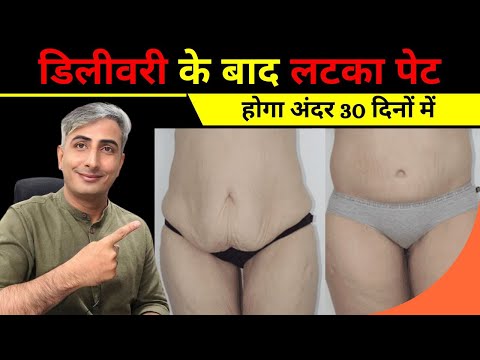 डिलीवरी के बाद पेट कम कैसे करे I डिलीवरी या सिजेरियन के बाद बड़े पेट को कैसे कम करें I DR. MANOJ DAS