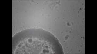 Nitrosomonas and Nitrobacter