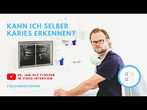 Video: So Erkennen Sie, Wann Zähne Geschnitten Werden