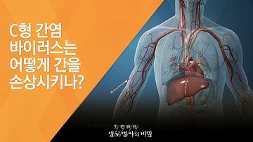 C형 간염 바이러스는 어떻게 간을 손상시키나? - (20150121_532회 방송)_어느 날 갑자기 찾아오는 c형 간염 검진해 보셨나요?