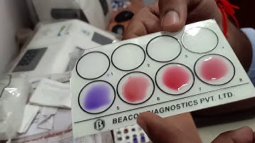 TYPHOID  IgM/IgG, WIDAL