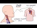 Understanding jugular venous pressure jvp