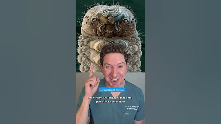 The MITES we ALL HAVE on our FACE?! #mites #demodex #skincare #derm