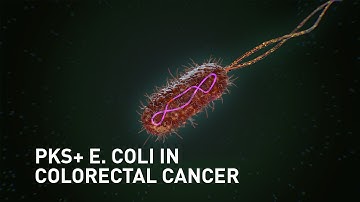A mutational signature in human colorectal cancer induced by genitoxic pks+ E. coli