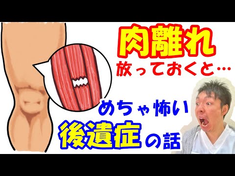 肉離れを放っておくとどうなる？実はめちゃ怖い肉離れの後遺症