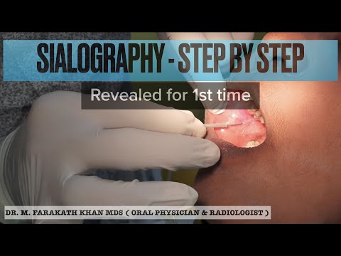SIALOGRAPHY | Step by Step | Revealed for 1st time
