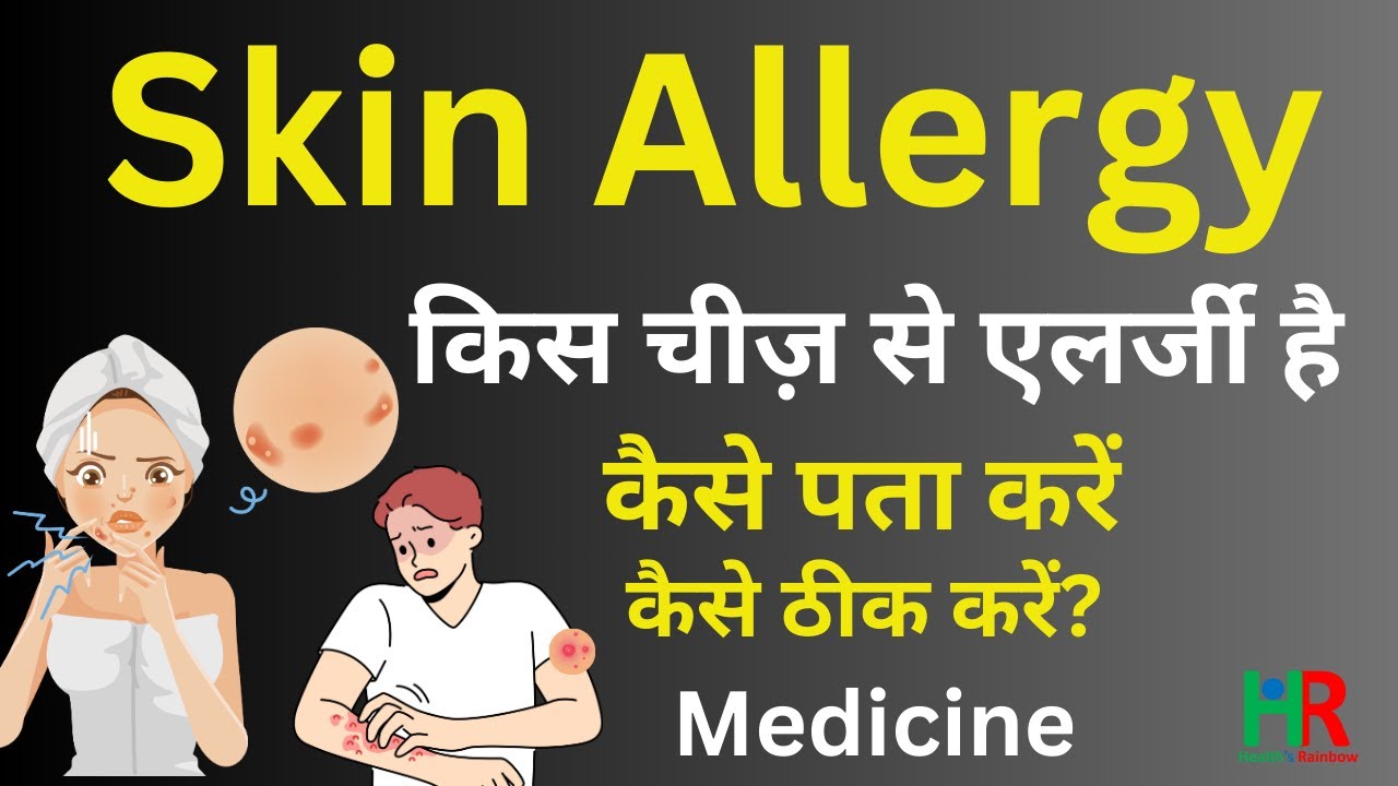 Skin Allergy symptoms causes diagnosis and treatment in hindi चमड़ी