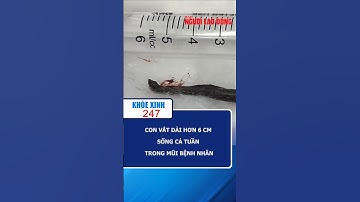 Con vắt dài hơn 6 cm sống cả tuần trong mũi bệnh nhân | Khỏe Xinh 247