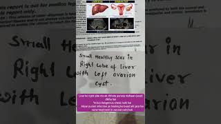 Liver Scar aur Ovarian Cyst kya hote hain? 🤔 | Real Case Study | Simple Explanation