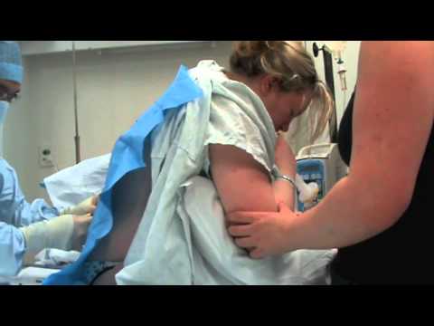 Epidural steroid injection lumbar video