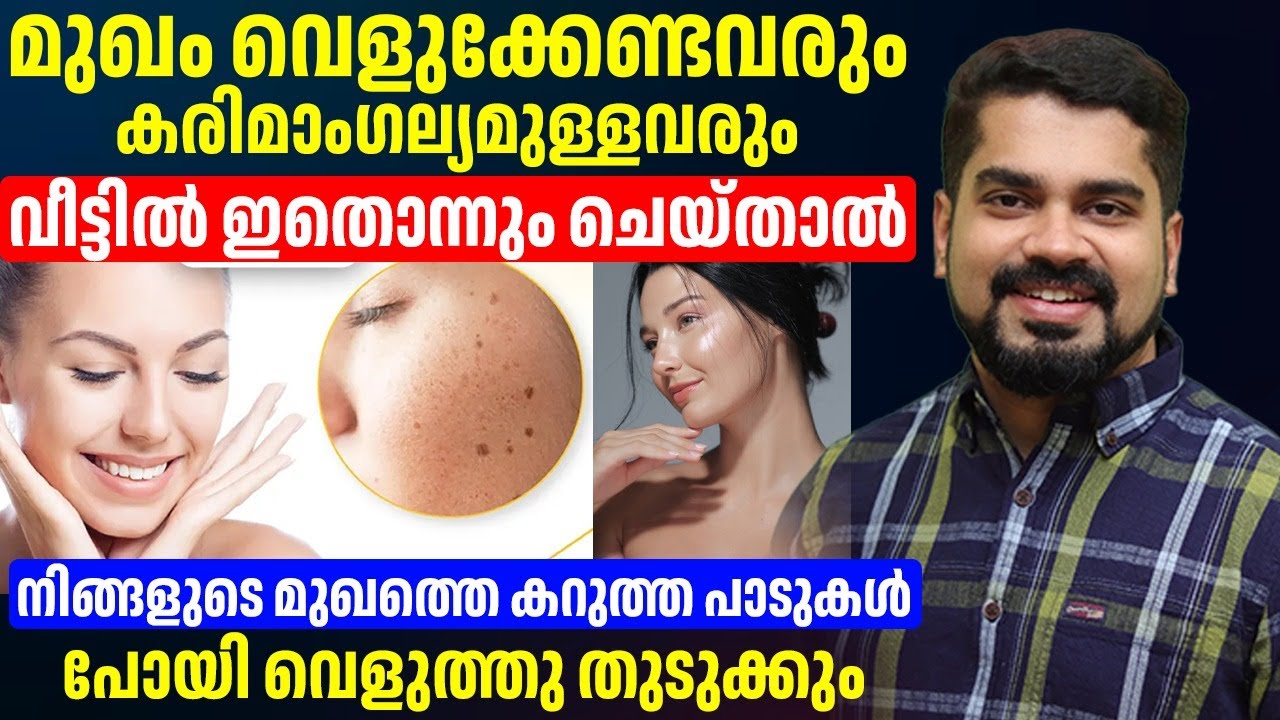 വീട്ടിൽ ഇതൊന്ന് ചെയ്താൽവെറും 5 മിനിറ്റ് നിങ്ങളുടെ മുഖത്തെ കറുത്ത പാടുകൾ പോയി വെളുത്തു തുടുക്കും