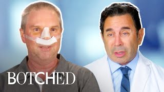 Did An IUD Deform David's Nose?! FULL TRANSFORMATION | Botched | E!