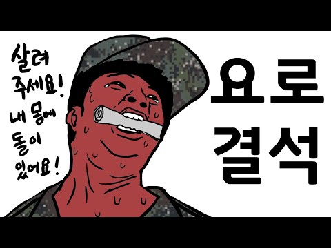 돌멩이를 낳은 일병. 군 병원 VIP의 비밀.
