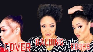 HOW TO COVER YOUR' THIN BALDING EDGES (ALOPECIA)