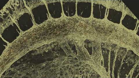 The Endothelial-to-Hematopoietic transition (EHT)