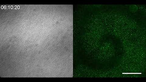 Live imaging of cell-cell signaling during the aggregation of Dictyostelium cells