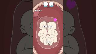 Celebrity How Do Conjoined Twins Form?    #animation#hot#funny #shorts Net Worth