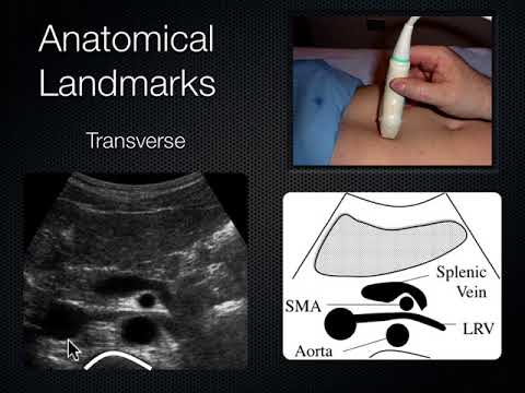 Kidney and Bladder Ultrasound e-learning