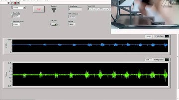 Wireless sEMG using Xbee Module_Rectus Femoris