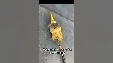 How an Edwards TAVR valve is deployed to treat aortic stenosis  #TAVR #cardiology