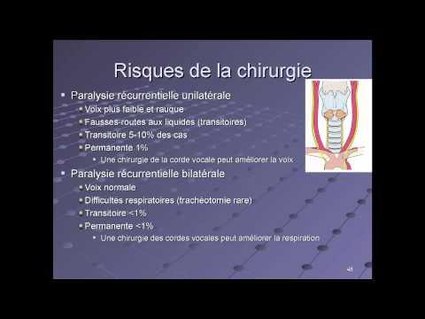 Thyroïde : les risques de la chirurgie.