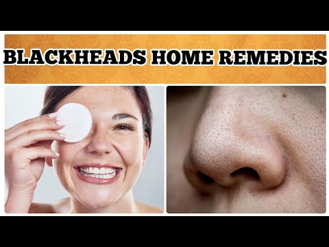 Home Remedies For Blackheads And How To Avoid Blackheads