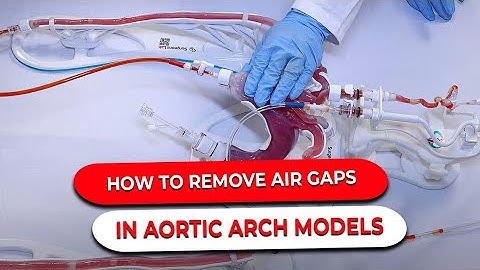 How to Remove air gaps in Aortic Arch Models: A Step-by-Step Guide | SurgeonsLab AG