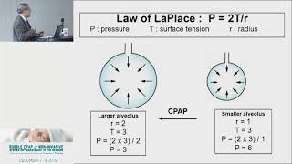 Lecture (1): Nuts and Bolts of Bubble CPAP