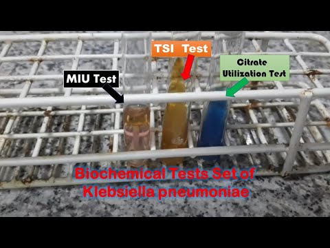 Video: Klebsiella Pneumoniae Karbapenemaza (KPC) Koja Proizvodi Klebsiella Pneumoniae ST258 Izolirana Od Japanskog Pacijenta Bez Povijesti Inozemnih Putovanja - Nova Briga Za Javno Zdravs