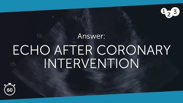60 Seconds of Echo Teaching Answer: Echo after coronary intervention