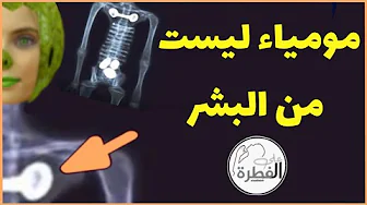 ما قصة اكتشاف زاحفة بشرية غريبة و ما علاقة زراعة الثدي التجميلية بهذا الكائن المرعب