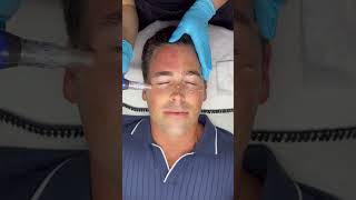 SkinPen Microneedling with Jet Setter John Philp Thompson III