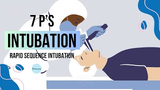 From Preparation to Procedure: Navigating the 7 Ps of Intubation - Medicotes