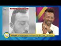 Teo Show - Kamara, interventie estetica la ochi: si-a taiat pleoapele!