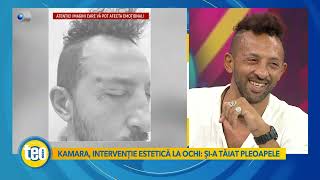 Teo Show - Kamara, Interventie Estetica La Ochi: Si-A Taiat Pleoapele!