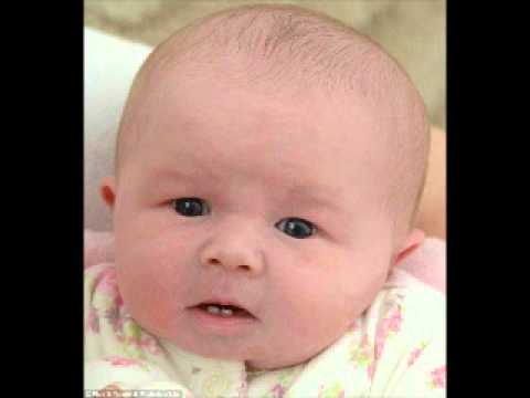 BABY BORN WITH TEETH Mother Refuses Breastfeeding YouTube BABY BORN WITH TEETH Mother Refuses Breastfeeding YouTube