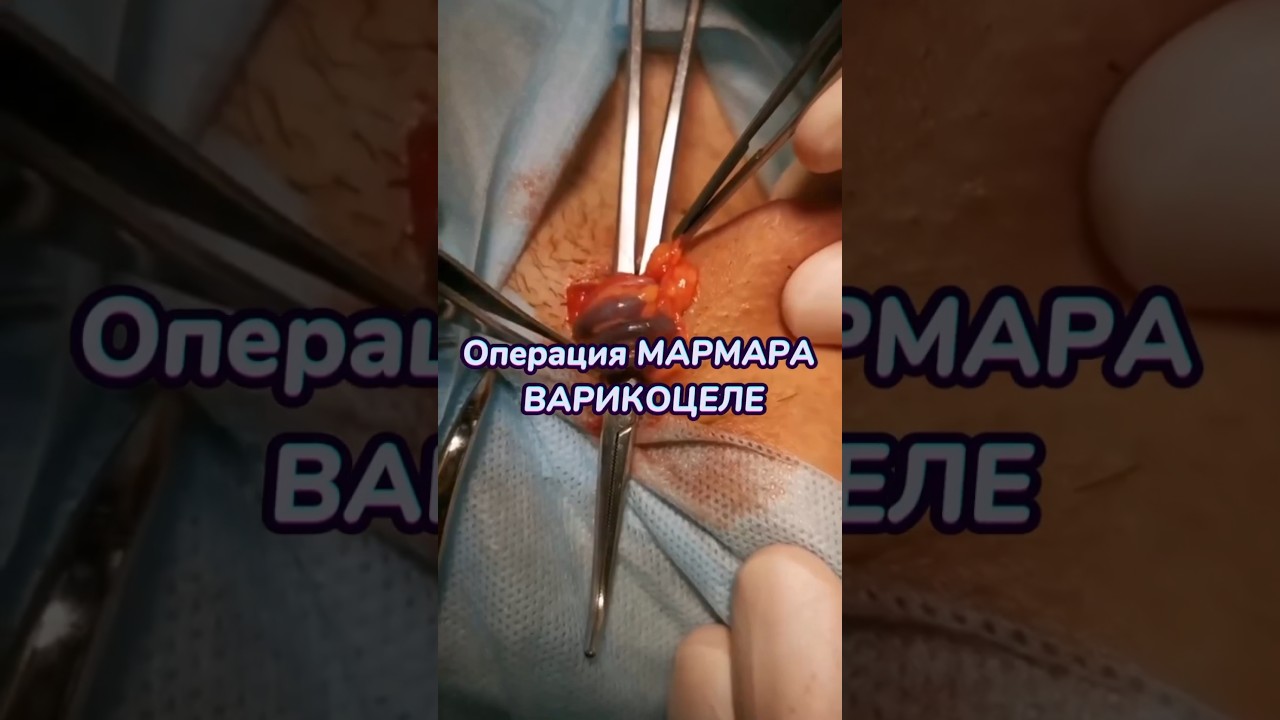 операция Мармарис