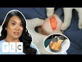 Dr. Lee Removes 16 Lipomas In Life-Threatening Surgery! I Dr. Pimple Popper: Pop Ups