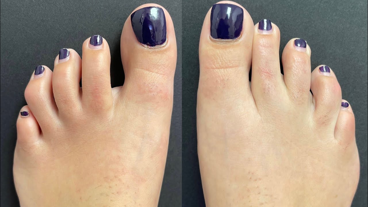 THE MERMAID MAKEOVER SURGERY THINNER & SMALLER FEET YouTube