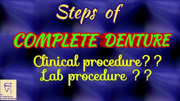 Complete Denture procedure | Steps of Complete Denture