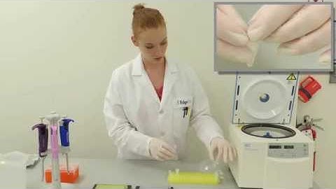 Big Dye Terminator Removal with Performa® DTR