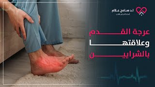 اسباب العرج أو التواء القدم وعلاقته بأمراض القلب الخطيرة! | د سامح علام