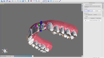 BlueSkyPlan Ortho v4.2.5 - (8) - Button Positioning