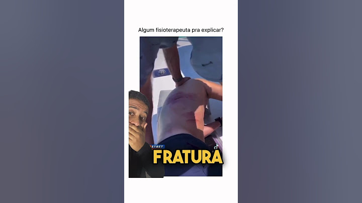 FRATURA ? 🔥 #shortsvideo #dicasincriveis #fisioterapia #acidente #ossos #fratura