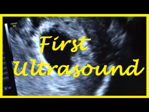 is-there-a-heartbeat?!?-first-ultrasound!-7-weeks-first-child-ivf-icsi-success