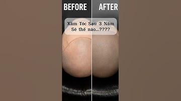 “Sự Thật Sau Vài Năm Xăm Tóc – Ai Cũng Nên Xem Trước Khi Làm!” Smp hair tattoo #reviewxămtóc