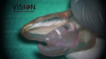 Simple and easy technique for placing water based Calcium hydroxide medicament